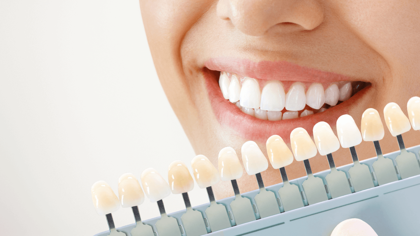 Teeth Whitening Zoom Teeth Whitening