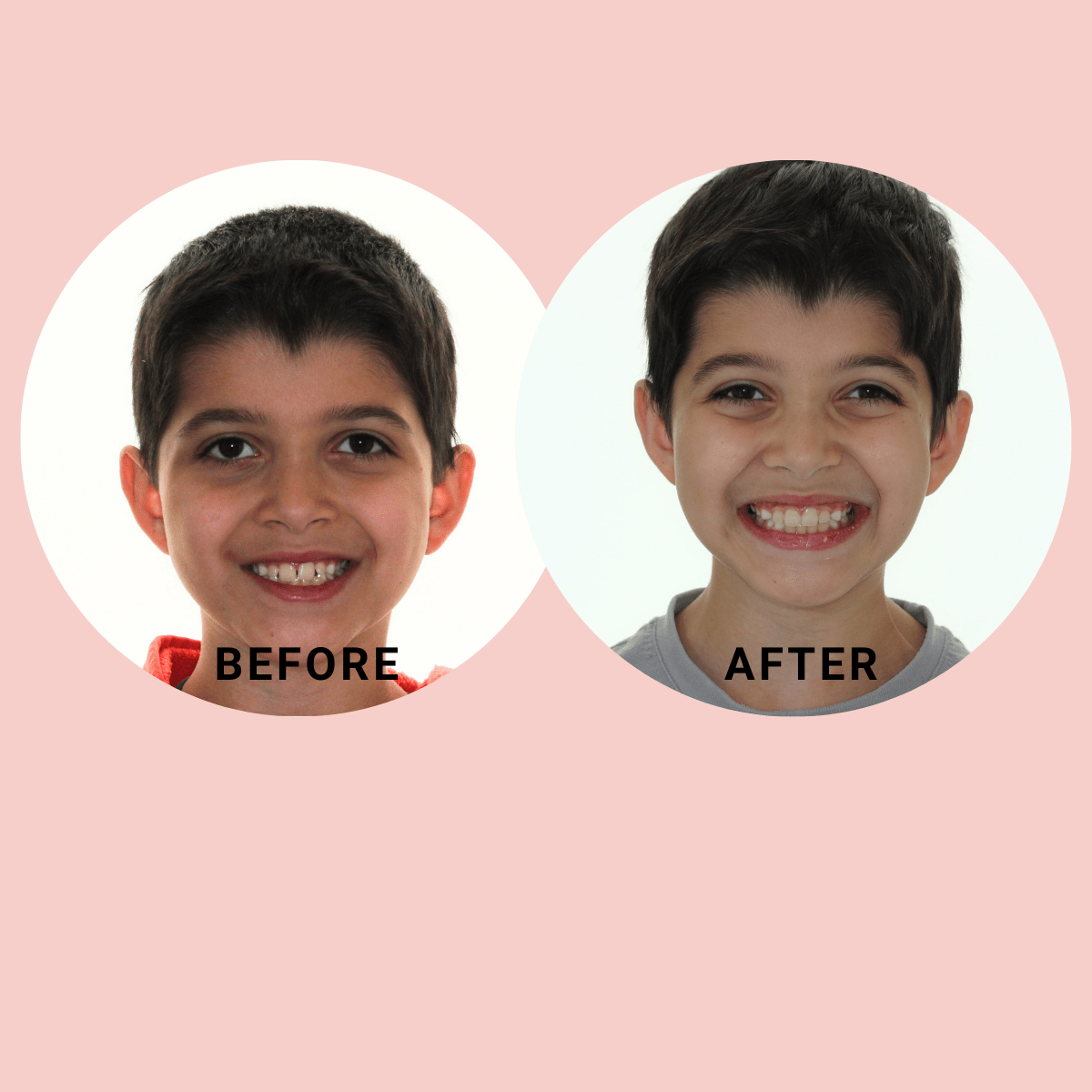 Kids Before and After Phase 1