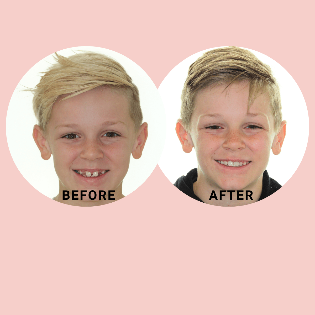 Kids Before and After Phase 1