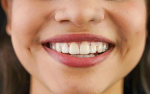 Emerick Orthodontics Aligners
